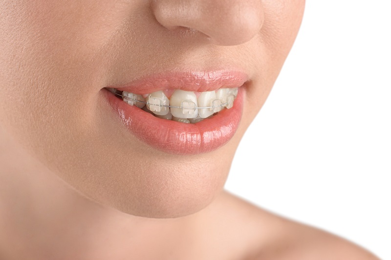 orthodontics glendale az