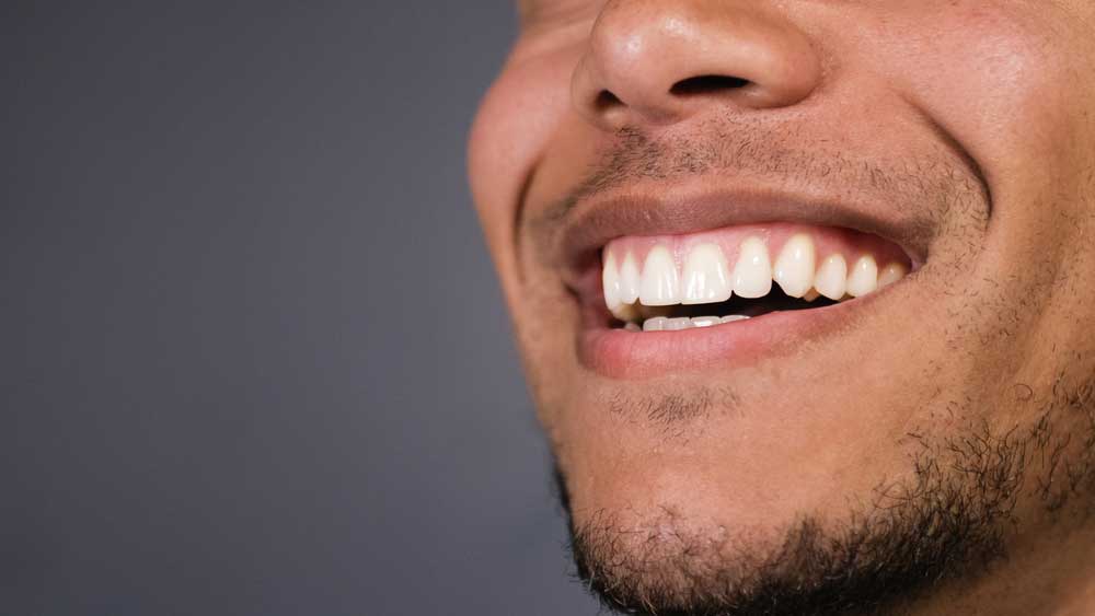 patient smiling after his professional teeth whitening