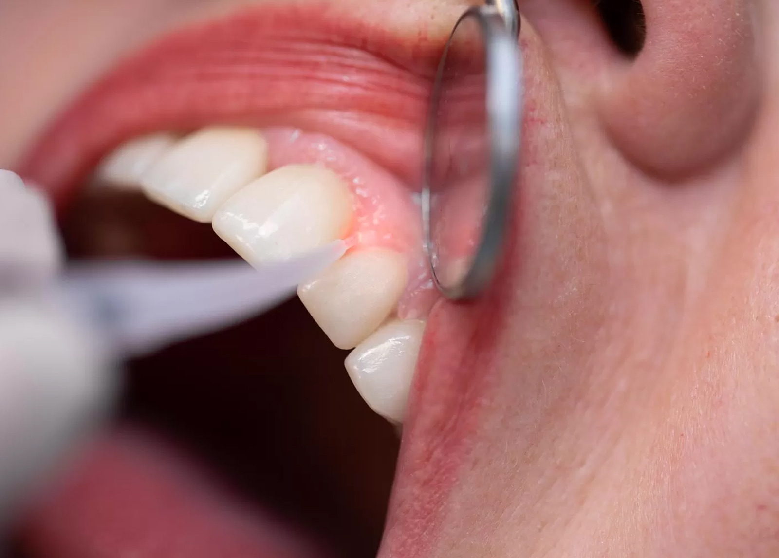 Comprehensive family dentistry in Phoenix