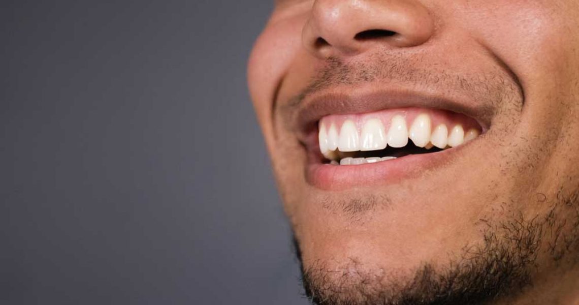 patient smiling after his professional teeth whitening